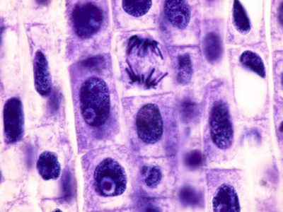 Schnitt durch eine Bohnenwurzel mit Mitosen