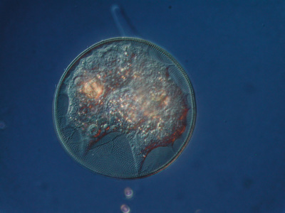 Am&ouml;be der Gattung Arcella