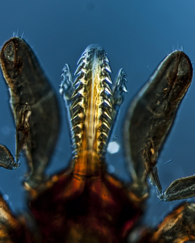 Stechwerkzeug einer Zecke