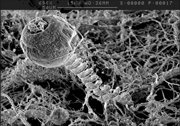 Glockentierchen im Rasterelektronenmikroskop