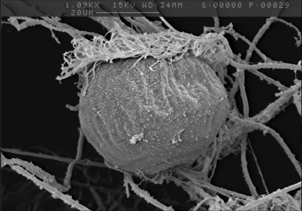 Glockentierchen im Rasterelektronenmikroskop