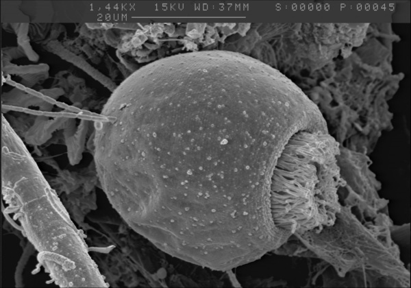 Glockentierchen im Rasterelektronenmikroskop