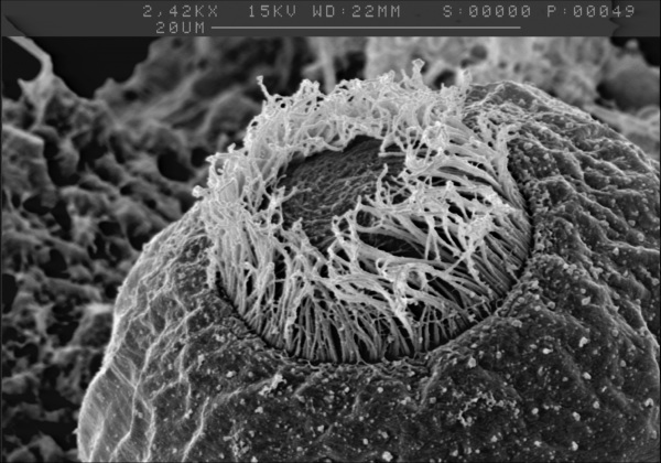 Glockentierchen im Rasterelektronenmikroskop