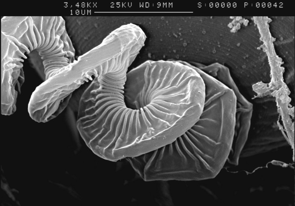 Glockentierchen im Rasterelektronenmikroskop